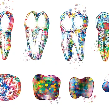 Kanvas Glezna, Zobu Implantācija, Zobu Kronis Plakāti Zobārsts Dāvanu Zobu Anatomija Medicīniskā Sienas Art Pictures Zobārstniecības Klīnika Dekori